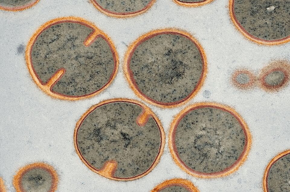 Staphylococcus aureus unter dem Mikroskop